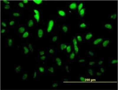 Immunocytochemistry/ Immunofluorescence: TCF4 Antibody (3E10) [H00006925-M01]