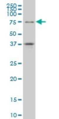 Western Blot: TCF4 Antibody (3E10) [H00006925-M01]