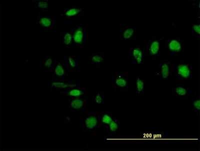 Immunocytochemistry/ Immunofluorescence: TCF4 Antibody (3H4) [H00006925-M04]