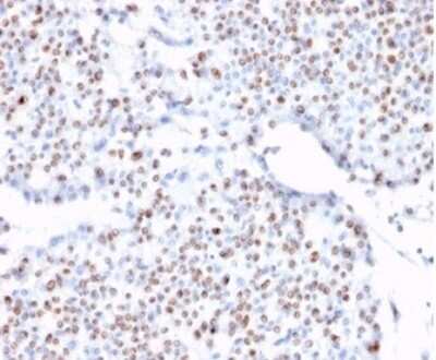 Immunohistochemistry-Paraffin: TCF4 Antibody (TCF4/1705) [NBP3-07336]