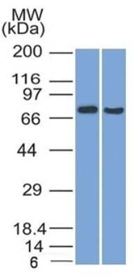 Western Blot: TCF4 Antibody (TCF4/1705) [NBP3-07336]