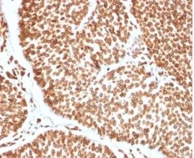 Immunohistochemistry-Paraffin: TCF4 Antibody (TCF4/2252) [NBP3-13789]