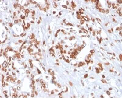 Immunohistochemistry-Paraffin: TCF4 Antibody (TCF4/2252) [NBP3-13789]