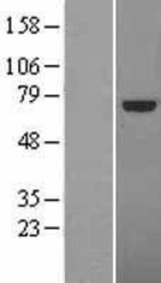 Western Blot: TCF4 Overexpression Lysate [NBL1-16775]