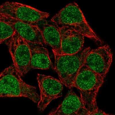Immunocytochemistry/ Immunofluorescence: TCF7/TCF1 Antibody [NBP2-57570]