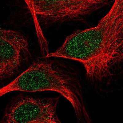 Immunocytochemistry/ Immunofluorescence: TCF7/TCF1 Antibody [NBP2-58213]