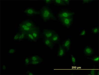 Immunocytochemistry/ Immunofluorescence: TCF7L2 Antibody (3A4) [H00006934-M06]