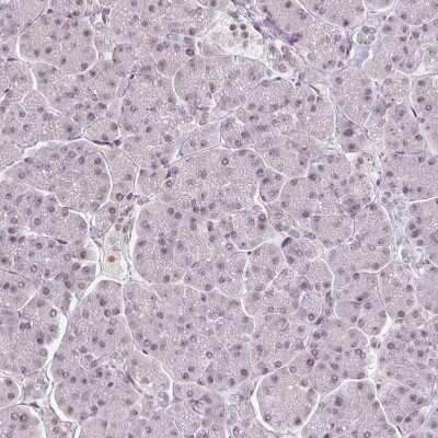 Immunohistochemistry-Paraffin: TCFL5 Antibody [NBP2-49174]