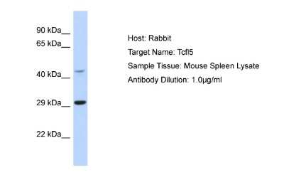 Western Blot: TCFL5 Antibody [NBP2-88425]
