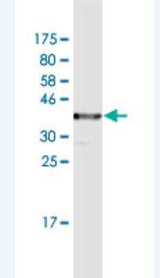 Western Blot: TCIRG1 Antibody (7H20) [H00010312-M02]