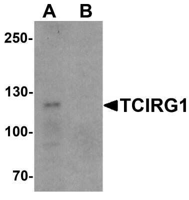 Western Blot: TCIRG1 AntibodyBSA Free [NBP2-81936]
