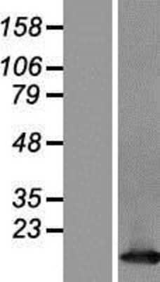 Western Blot: TCL1A Overexpression Lysate [NBP2-11427]