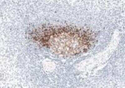 Immunohistochemistry-Paraffin: TCL1A Antibody (1-21) - BSA Free [NBP1-43253]