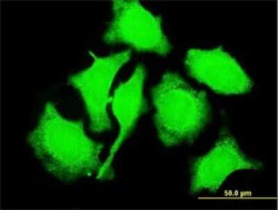 Immunocytochemistry/ Immunofluorescence: TCL1A Antibody (1C4) [H00008115-M06]