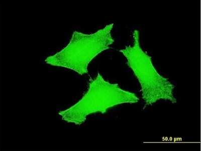 Immunocytochemistry/ Immunofluorescence: TCL1A Antibody (2F1) [H00008115-M03]