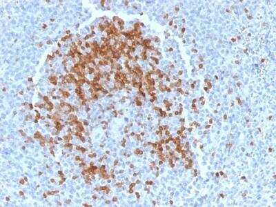 Immunohistochemistry-Paraffin: TCL1A Antibody (TCL1/2078) [NBP2-75747]