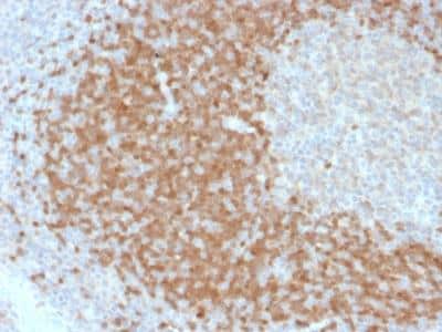 Immunohistochemistry-Paraffin: TCL1A Antibody (TCL1/2078) [NBP2-75747]