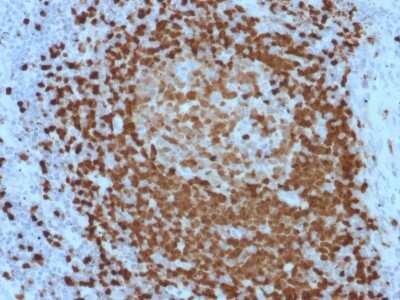 Immunohistochemistry-Paraffin: TCL1A Antibody (TCL1/2079) [NBP3-11311]