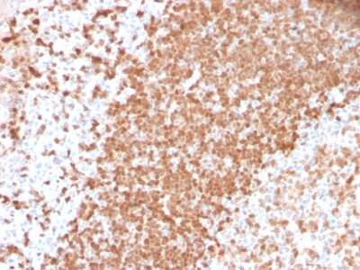 Immunohistochemistry-Paraffin: TCL1A Antibody (TCL1/2747R) [NBP3-07379]