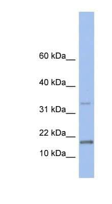 Western Blot: TCL1A Antibody [NBP1-54693]