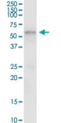 Immunoprecipitation: TCN1 Antibody [H00006947-D01P]