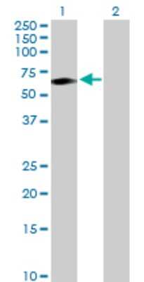 Western Blot: TCN1 Antibody [H00006947-D01P]