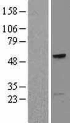 Western Blot: TCN1 Overexpression Lysate [NBL1-16783]