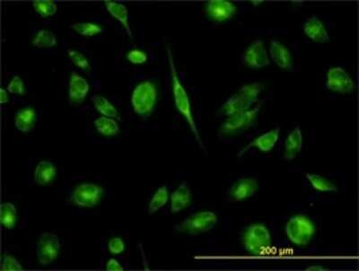 Immunocytochemistry/ Immunofluorescence: TCP1 alpha Antibody (2B2-D6) [H00006950-M01]