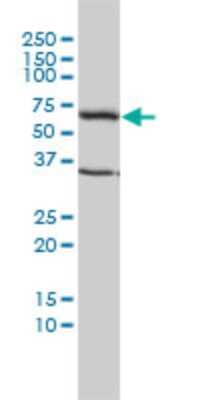 Western Blot: TCP1 alpha Antibody (2B2-D6) [H00006950-M01]