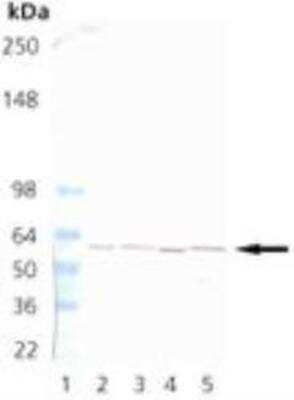 Western Blot: TCP1 alpha Antibody (91a) [NBP1-97505]