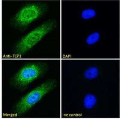 Immunocytochemistry/ Immunofluorescence: TCP1 alpha Antibody [NB100-1400]