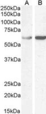 Western Blot: TCP1 alpha Antibody [NB100-1400]
