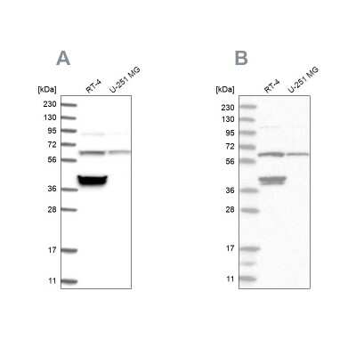 Western Blot: TCP1 alpha Antibody [NBP1-88149]