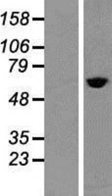 Western Blot: TCP1 alpha Overexpression Lysate [NBP2-06194]
