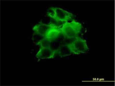Immunocytochemistry/ Immunofluorescence: TCP1-beta Antibody (2G6) [H00010576-M01]