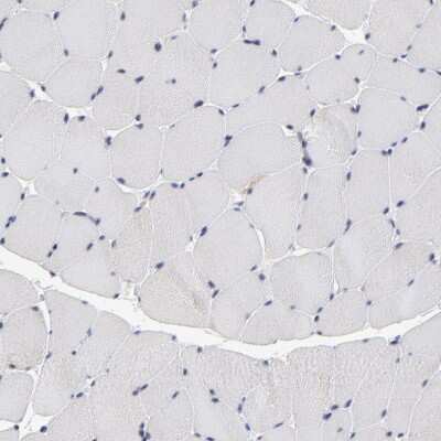 Immunohistochemistry-Paraffin: TCP1-beta Antibody [NBP1-88147]