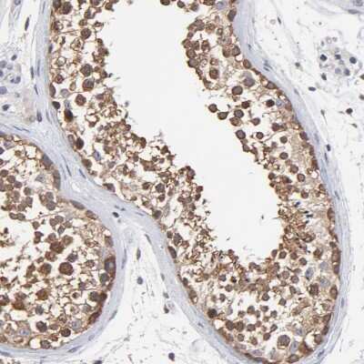 Immunohistochemistry-Paraffin: TCP1-beta Antibody [NBP1-88147]