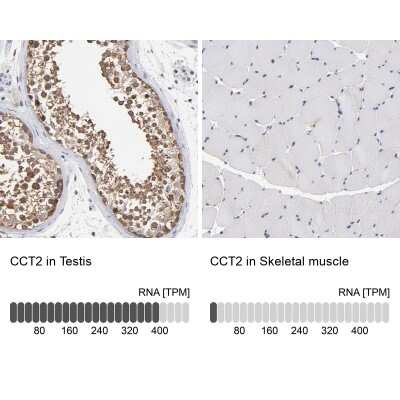 Immunohistochemistry-Paraffin: TCP1-beta Antibody [NBP1-88147]