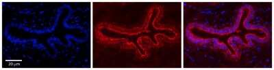 Immunohistochemistry-Paraffin: TCP1-delta Antibody [NBP3-10317]