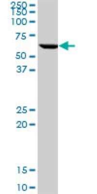 Western Blot: TCP1-eta Antibody (1D6) [H00010574-M01]