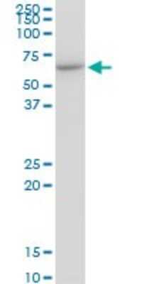 Western Blot: TCP1-eta Antibody (1D6) [H00010574-M01]