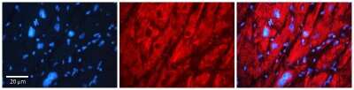 Immunohistochemistry: TCP1-eta Antibody [NBP1-58218]