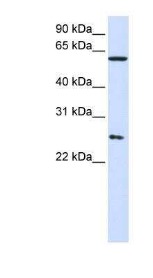 Western Blot: TCP1-eta Antibody [NBP1-58218]