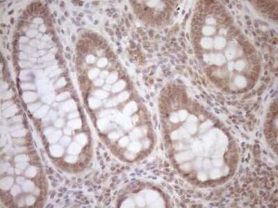 Immunohistochemistry: TCP10 Antibody (OTI2C2) - Azide and BSA Free [NBP2-74474]