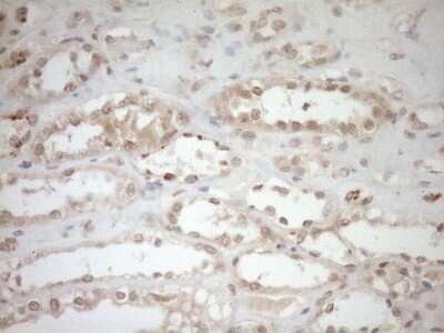 Immunohistochemistry: TCP10 Antibody (OTI2C2) - Azide and BSA Free [NBP2-74474]