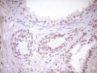 Immunohistochemistry: TCP10 Antibody (OTI2C2) - Azide and BSA Free [NBP2-74474]