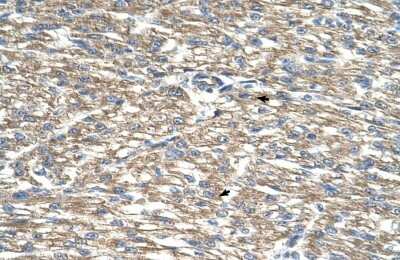 Immunohistochemistry-Paraffin: TCP10L Antibody [NBP1-52846]