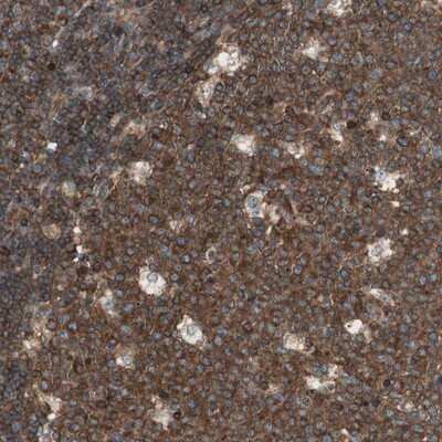 Immunohistochemistry-Paraffin: TCP11L1 Antibody [NBP1-83749]