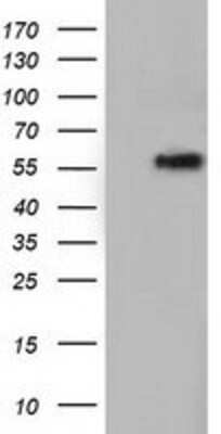 Western Blot: TCP11L2 Antibody (OTI2A10) [NBP2-03100]