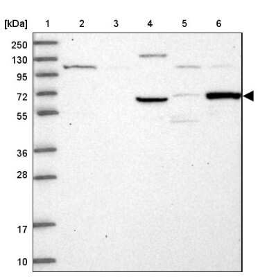 Western Blot: TCP11L2 Antibody [NBP1-82695]